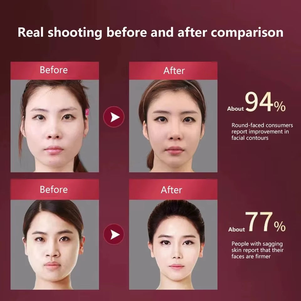 LED Photon Therapy Facial Slimming Vibration Massager Facial Lifting Device Facial Heated Double Chin V Face Vibration Massager